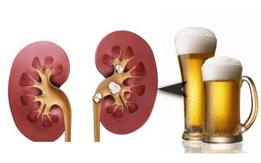 O efecto do alcol nos riles